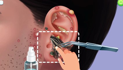 ASMRtreatment: Relaxing ear wax cleaning and tonsil stone removal for ultimate relaxation.