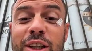 Marco Costa sobre ferida no rosto