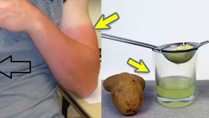 Hand Tan Removal At Home: धूप में हाथ काला पड़ने पर क्या करें | Hath Kale Pad Jaye To Kya Karen ?