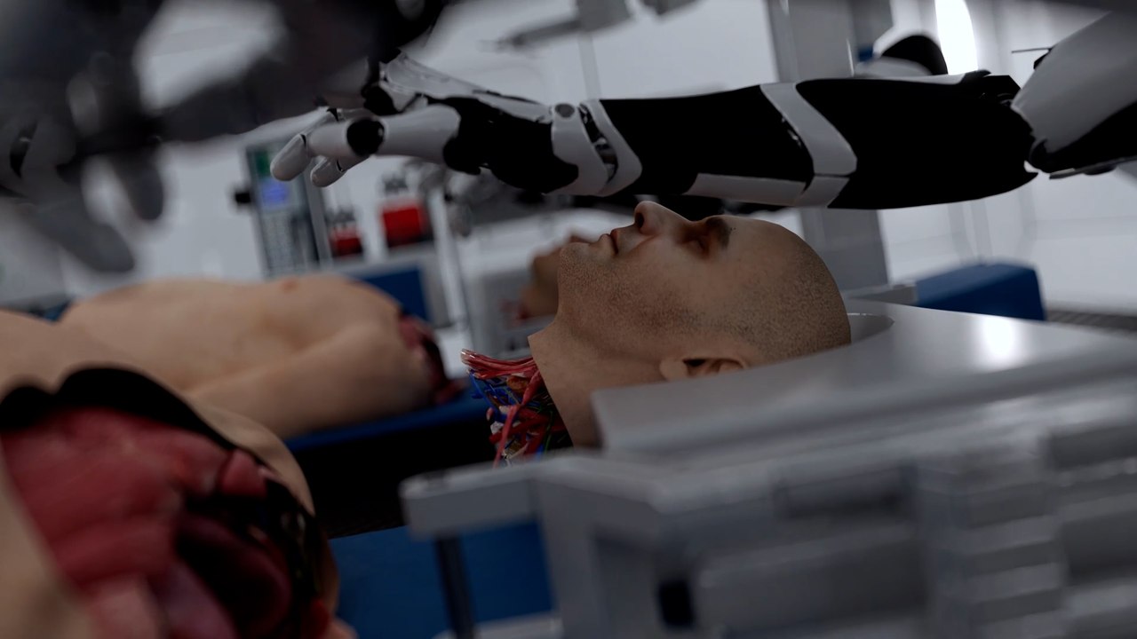 World’s first head transplant system unveiled
