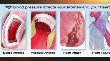 High Blood Pressure - Part 3 | Frequently Asked Questions | Urdu | Hindi | Shahbaz Qamar