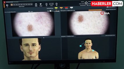 Deri kanserinde erken teşhis önemli