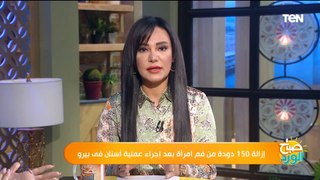 إزالة 150 دودة من فم امرأة بعد إجراء عملية أسنان.. ود. أحمد يوسف جمال يكشف الأسباب ويحذر