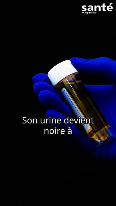 Son urine devient noire à cause de la cigarette électronique