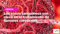 Los vasos sanguíneos son clave en el tratamiento de tumores cerebrales