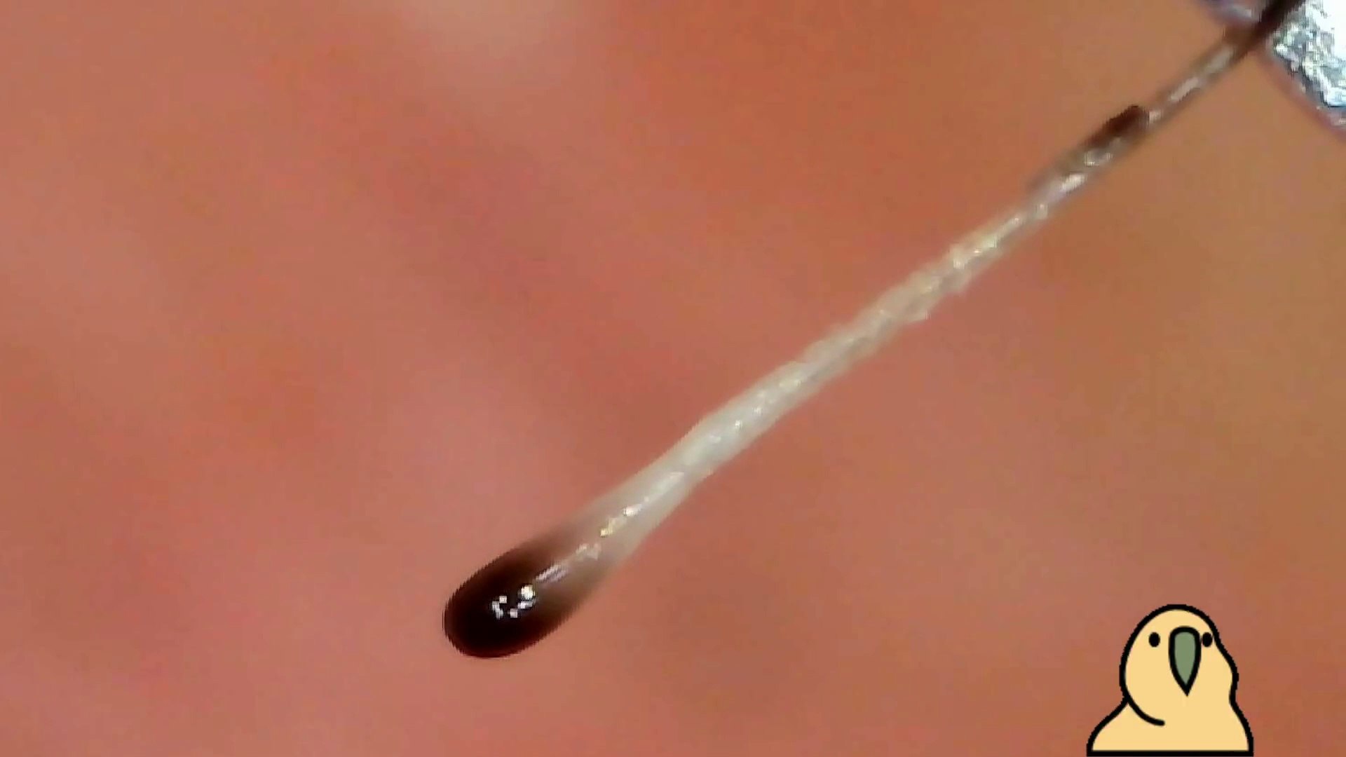 ⁣Microscopic beard removal. / Élimination microscopique de la barbe. #02