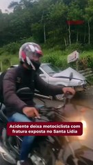 Acidente deixa motociclista com fratura exposta no Santa Lídia