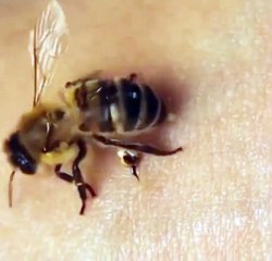 This is how a bee stings a human.#bee#human#skin# #Dailymotion #Vid #Video