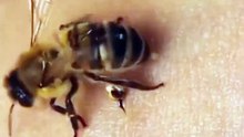 This is how a #bee stings a #human.