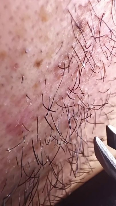 【short Ver.】Tweezers to invade the bearded planet / 【short Ver.】Tweezers pour envahir la planète des barbus.