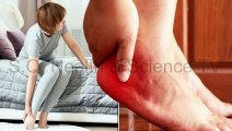 Heel Pain? Causes, Symptoms, Diagnosis, Risk Factors  and Prevention | Urdu | Hindi | Shahbaz Qamar