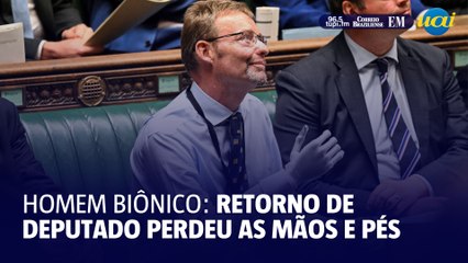 Deputado que perdeu as mãos e pés recebe aplauso no Parlamento