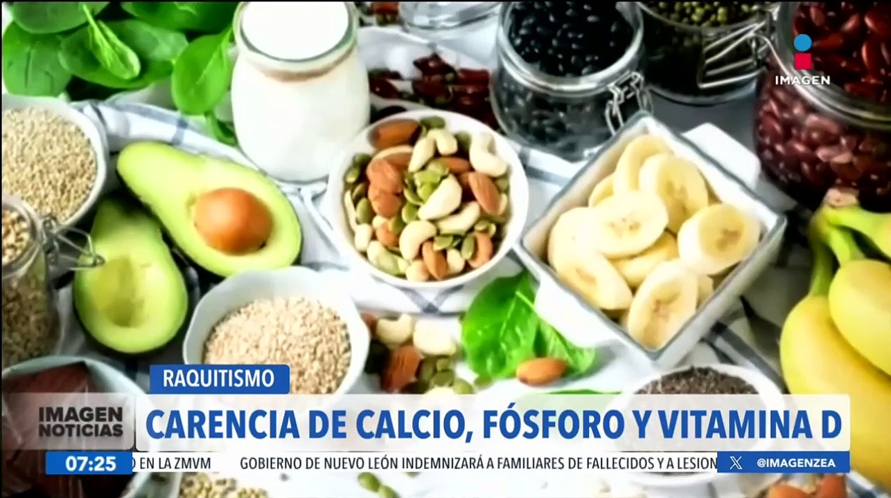 ¿Qué es el raquitismo y cuáles son sus síntomas?