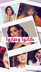 الدانة مودل قبل وبعد التجميل