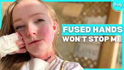 My Butterfly Skin Rips With The Softest Touch | BORN DIFFERENT