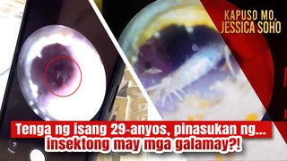 Tenga ng isang babae, pinasok ng isang insektong may mga galamay?! | Kapuso Mo, Jessica Soho