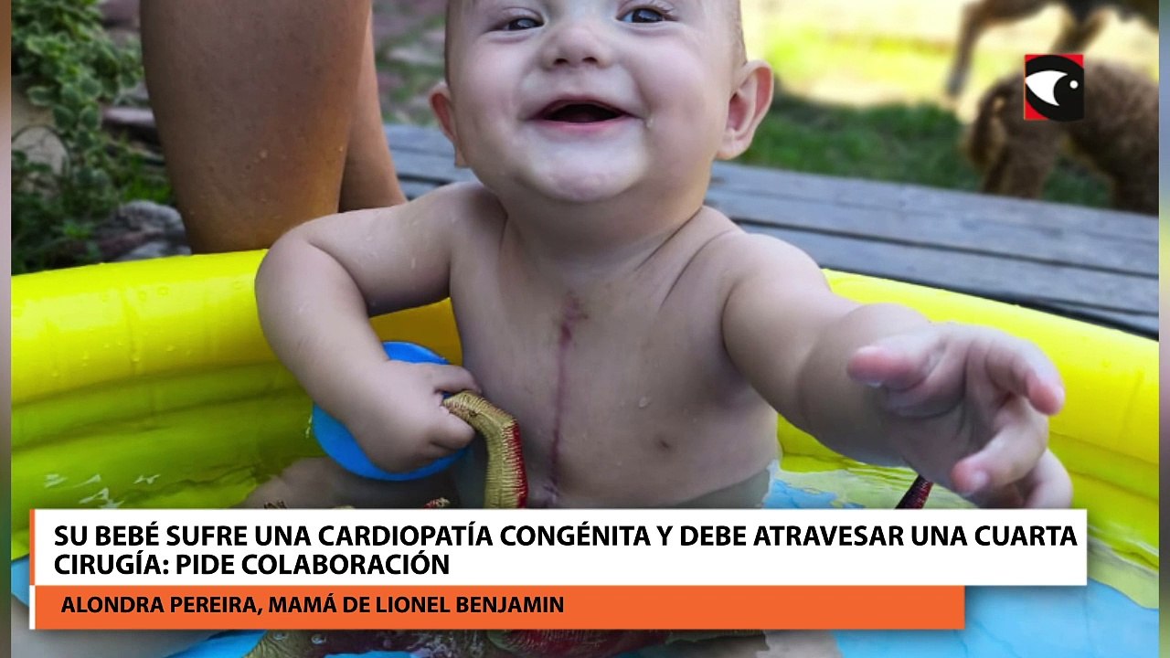 Su bebé sufre una cardiopatía congénita y debe atravesar una cuarta cirugía pide colaboración