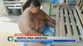 Derita Pemuda Obesitas di Sragen, Berat Badan Capai 165 Kg