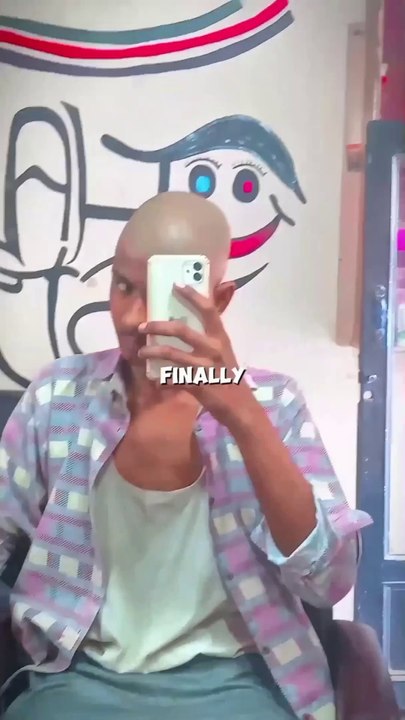 Finally I got Bald
