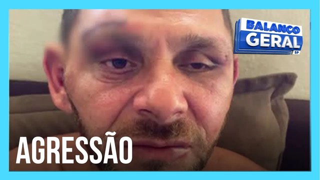 Homem denuncia GCM de Socorro, no interior de SP, e afirma que foi espancado por guardas