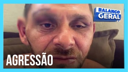 Homem denuncia GCM de Socorro, no interior de SP, e afirma que foi espancado por guardas