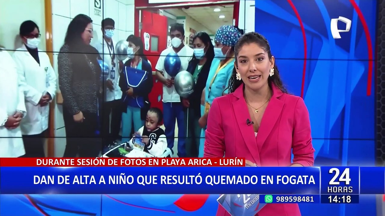 San Borja: dan de alta a menor que sufrió graves quemaduras en sesión fotográfica