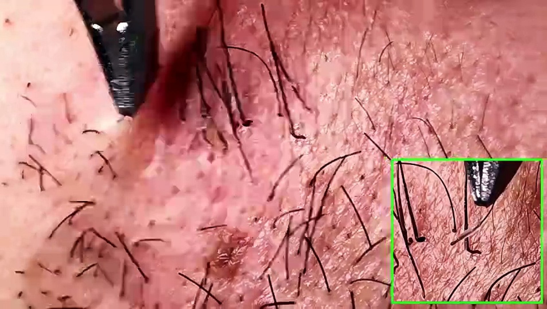 ⁣Retirer la barbe à l'aide d'une pince à épiler / Remove the beard with tweezers.