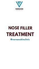 Download Video: Natural Nose Enhancement with Fillers in Hyderabad | Vernon Skin & Hair