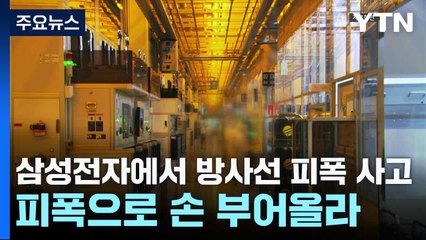 삼성전자에서 방사선 피폭 사고...피폭으로 손 부어올라 / YTN