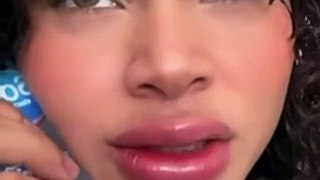 Cesia Sáenz aparece con sus labios inflamados ¿Exceso de bótox?