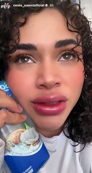 Cesia Sáenz aparece con sus labios inflamados ¿Exceso de bótox?