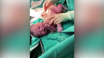 Equipe médica fica surpresa com recém nascido com seis 'dentes' em MS