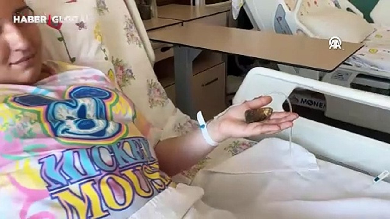 Safra kesesinden 6 santimetrelik taş çıkarıldı: "Böyle bir taş daha önce görülmemiş, herkes şaşkın"