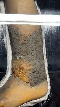 Reportage : Le musée des moulages