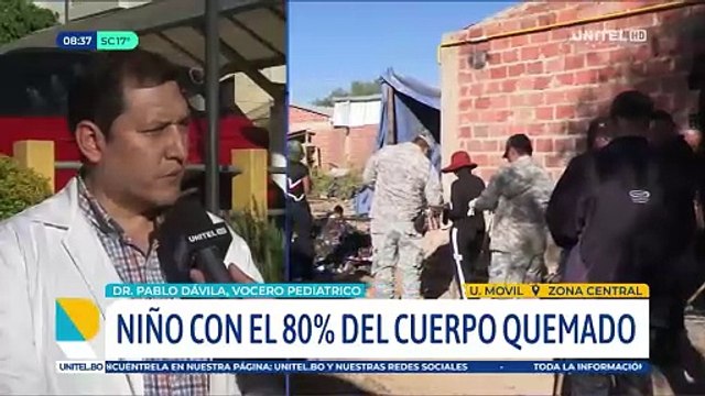 Adolescente afectado en el incendio de su casa tiene el 80% del cuerpo quemado y permanece en terapia intensiva