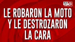 Le robaron la moto y le destrozaron la cara a culatazos