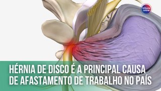 Hérnia de disco é a principal causa de afastamento de trabalho no país | Fala, Doutor!