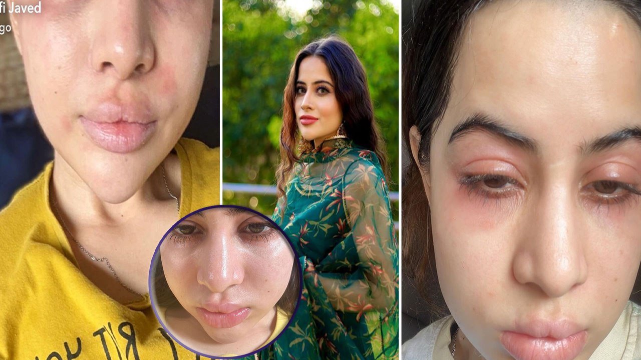 Urfi Javed का बिगड़ा Face देख हैरान fans ने पूछे सवाल- क्यों कराती हो इतनी Surgery? FilmiBeat