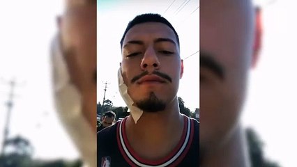 Com bala alojada na nuca, jovem que foi vítima de submetralhadora em tiroteio contra tabacaria deixa hospital