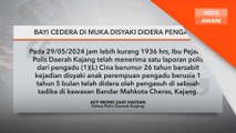 Bayi cedera di muka disyaki didera pengasuh