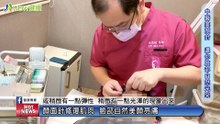 中醫顏面針灸博大精深 解決臉部問題不靠醫美也行｜麗馨中醫診所 - 新聞影片 ｜遠大整合行銷