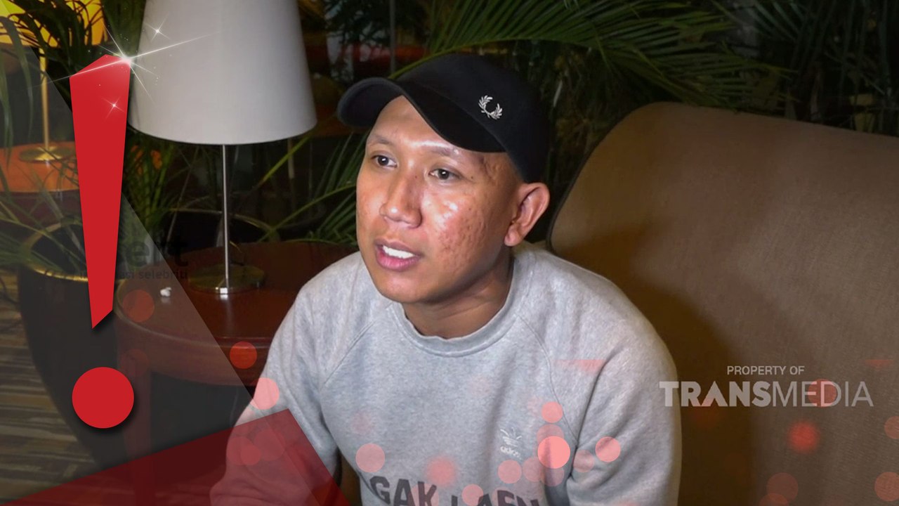 Karier Aktingnya Mulus, Oki Rengga Akui Star Syndrome