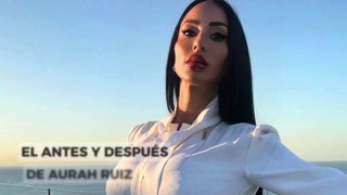 El antes y después de Aurah Ruiz