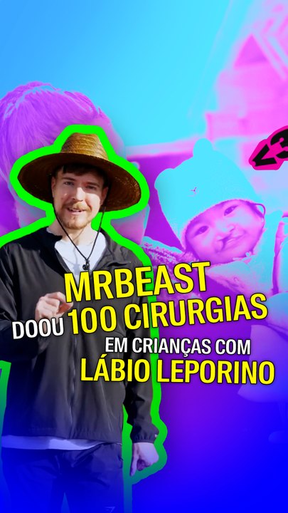 MrBeast doou 10 cirurgias em crianças com lábio leporino