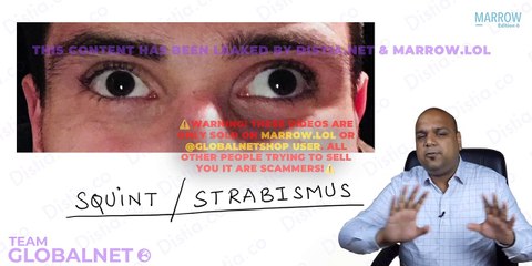 Squint extra ocular muscle