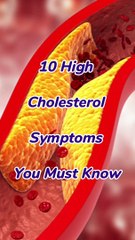 10 High Cholesterol Symptoms You Must Know: Essential Health Alert #shorts #viral #top #health