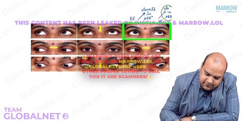 restrictive squint opthalmology