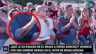 ¿Qué le ha pasado en el brazo a Pedro Sánchez? Aparece con una enorme herida en el mitin de Benalmádena