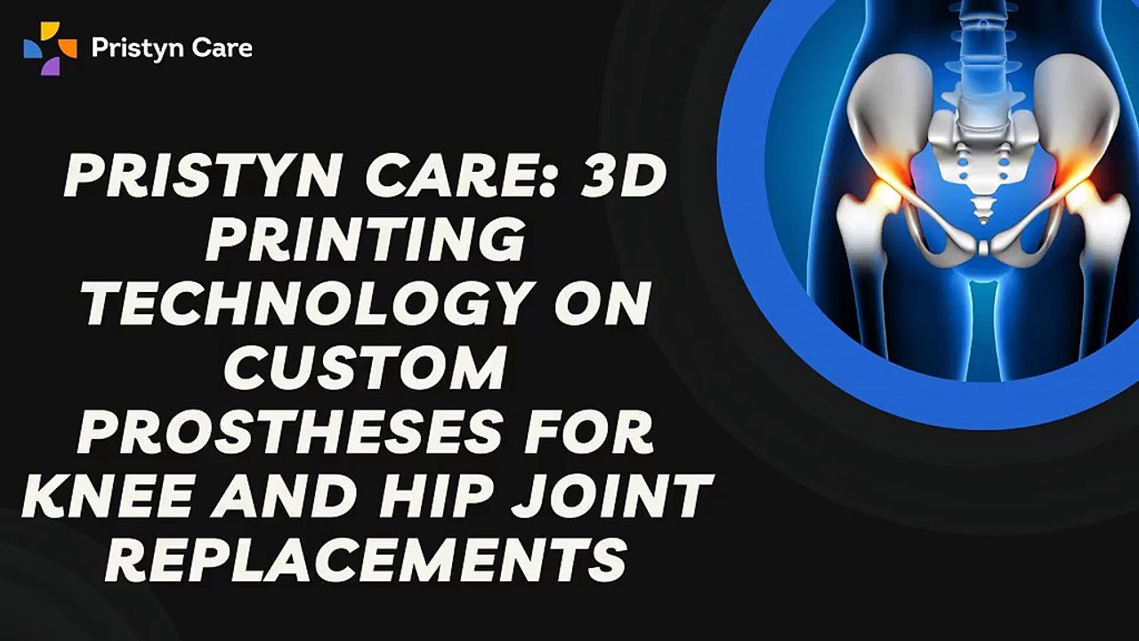 Pristyn Care: 3D Printing Technology on Custom Prostheses for Knee and Hip Joint Replacements