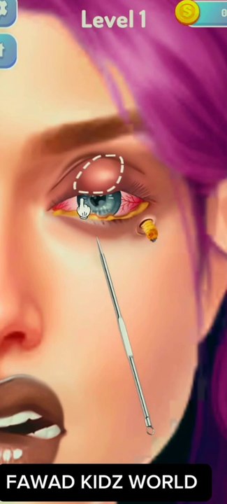 ASMR Remove Trypophobia Maggot & Infected Face | Deep Cleaning asmr Animation Treatment | Facial